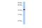 Tumor necrosis factor receptor superfamily member EDAR antibody, A02639-1, Boster Biological Technology, Western Blot image 