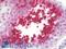 Tissue Specific Transplantation Antigen P35B antibody, LS-B9837, Lifespan Biosciences, Immunohistochemistry paraffin image 