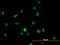 Histone Deacetylase 1 antibody, LS-B6095, Lifespan Biosciences, Immunofluorescence image 