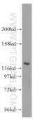 Acyl-CoA Dehydrogenase Family Member 10 antibody, 17161-1-AP, Proteintech Group, Western Blot image 