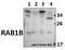 RAB1B, Member RAS Oncogene Family antibody, A04589, Boster Biological Technology, Western Blot image 