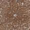 Poly(ADP-Ribose) Polymerase Family Member 11 antibody, PA5-55456, Invitrogen Antibodies, Immunohistochemistry paraffin image 