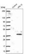 ADP Ribosylation Factor Like GTPase 10 antibody, NBP2-14311, Novus Biologicals, Western Blot image 