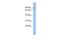 Nephrocystin 1 antibody, GTX45112, GeneTex, Western Blot image 