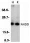 CASP2 And RIPK1 Domain Containing Adaptor With Death Domain antibody, 1115, QED Bioscience, Western Blot image 