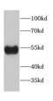 Cell Adhesion Molecule 1 antibody, FNab01189, FineTest, Western Blot image 