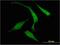 Regulator Of G Protein Signaling 14 antibody, H00010636-M03, Novus Biologicals, Immunocytochemistry image 