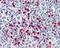 S100 Calcium Binding Protein A8 antibody, 48-019, ProSci, Western Blot image 