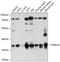 Proteasome 26S Subunit, Non-ATPase 14 antibody, A06584, Boster Biological Technology, Western Blot image 
