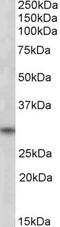 Four And A Half LIM Domains 3 antibody, PA5-18307, Invitrogen Antibodies, Western Blot image 