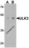 Unc-51 Like Kinase 3 antibody, 7585, ProSci Inc, Western Blot image 