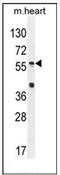 Sp8 Transcription Factor antibody, AP53993PU-N, Origene, Western Blot image 