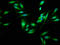 Spindle And Kinetochore Associated Complex Subunit 3 antibody, LS-C674568, Lifespan Biosciences, Immunofluorescence image 