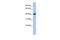 THAP Domain Containing 5 antibody, GTX45532, GeneTex, Western Blot image 