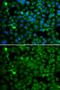 SET And MYND Domain Containing 4 antibody, GTX65838, GeneTex, Immunofluorescence image 