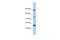 Lipocalin 6 antibody, A14831, Boster Biological Technology, Western Blot image 