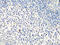 Metastasis Associated 1 Family Member 2 antibody, abx126193, Abbexa, Immunohistochemistry paraffin image 
