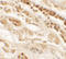 Tweety Family Member 2 antibody, A11764, Boster Biological Technology, Immunohistochemistry paraffin image 