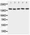 Replication Factor C Subunit 1 antibody, PA1716, Boster Biological Technology, Western Blot image 