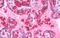 Hemoglobin Subunit Alpha 2 antibody, MBS245570, MyBioSource, Immunohistochemistry paraffin image 