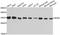 Ribosomal Protein S6 antibody, STJ25409, St John