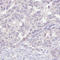 ERBB2 antibody, AMAb90628, Atlas Antibodies, Immunohistochemistry frozen image 