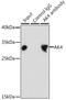 Adenylate kinase isoenzyme 4, mitochondrial antibody, GTX30038, GeneTex, Immunoprecipitation image 