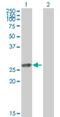 Thymidine Kinase 1 antibody, H00007083-B01P, Novus Biologicals, Western Blot image 