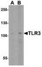 Toll Like Receptor 3 antibody, A00197-2, Boster Biological Technology, Western Blot image 