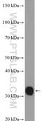 Thiosulfate Sulfurtransferase antibody, 16311-1-AP, Proteintech Group, Western Blot image 