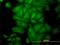 Tubulin Alpha 4a antibody, H00007277-M01, Novus Biologicals, Immunofluorescence image 