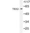 T-Box 2 antibody, LS-C176803, Lifespan Biosciences, Western Blot image 