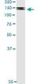 Platelet Derived Growth Factor Receptor Beta antibody, H00005159-M08, Novus Biologicals, Immunoprecipitation image 
