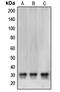 Carbonyl Reductase 1 antibody, MBS821894, MyBioSource, Western Blot image 