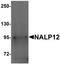 NLR Family Pyrin Domain Containing 12 antibody, TA320073, Origene, Western Blot image 
