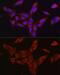 Furin, Paired Basic Amino Acid Cleaving Enzyme antibody, GTX55628, GeneTex, Immunofluorescence image 