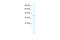 Hematopoietic Cell-Specific Lyn Substrate 1 antibody, 27-647, ProSci, Enzyme Linked Immunosorbent Assay image 