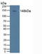 Phospholipase C Gamma 2 antibody, LS-C703765, Lifespan Biosciences, Western Blot image 