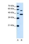Solute Carrier Family 39 Member 5 antibody, NBP1-69296, Novus Biologicals, Western Blot image 