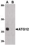 Autophagy Related 12 antibody, PA5-20464, Invitrogen Antibodies, Western Blot image 
