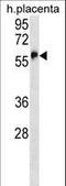 Zinc Finger Protein 57 antibody, LS-C157405, Lifespan Biosciences, Western Blot image 