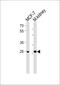 Carbonic Anhydrase 2 antibody, MBS9208816, MyBioSource, Western Blot image 