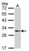 Transmembrane P24 Trafficking Protein 9 antibody, GTX102163, GeneTex, Western Blot image 