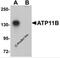 ATPase Phospholipid Transporting 11B (Putative) antibody, 5857, ProSci, Western Blot image 