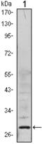 Acidic Nuclear Phosphoprotein 32 Family Member A antibody, M03625, Boster Biological Technology, Western Blot image 