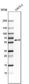 Regulator Of Microtubule Dynamics 3 antibody, NBP1-84738, Novus Biologicals, Western Blot image 