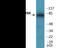 Ribosomal Protein S6 Kinase A1 antibody, EKC2100, Boster Biological Technology, Western Blot image 