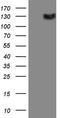 Colony Stimulating Factor 2 Receptor Beta Common Subunit antibody, TA807896S, Origene, Western Blot image 