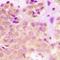 Neural Cell Adhesion Molecule 1 antibody, orb314883, Biorbyt, Immunohistochemistry paraffin image 