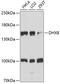 DEAH-Box Helicase 8 antibody, 15-685, ProSci, Western Blot image 